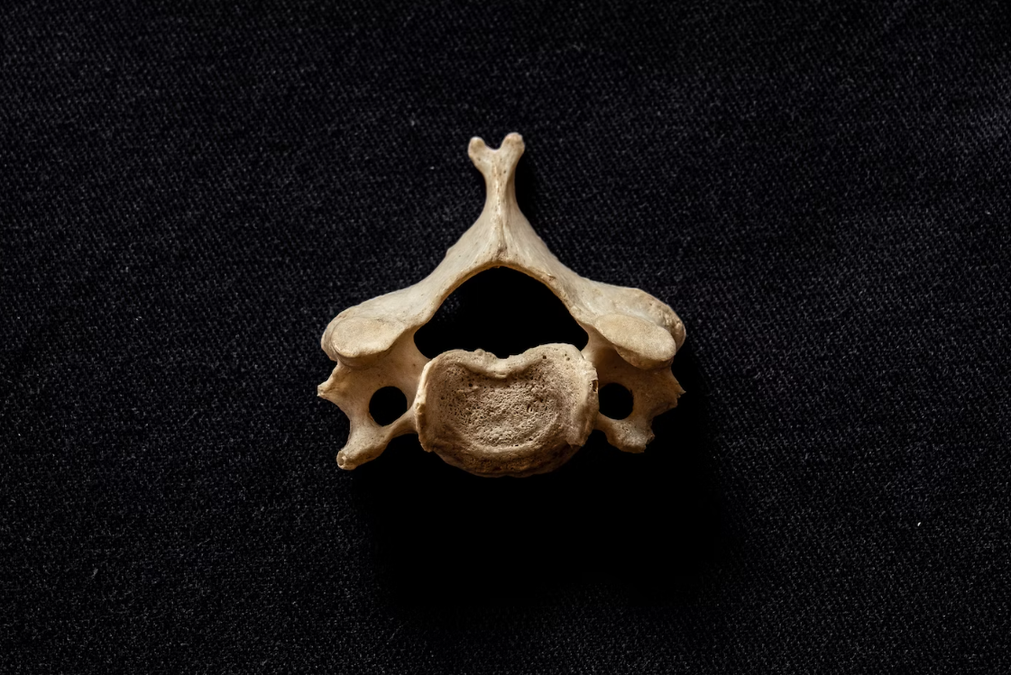 A middle cervical vertebra of human