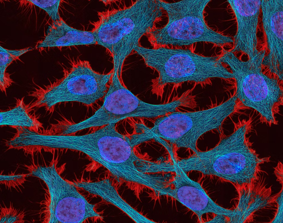 The human protein atlas