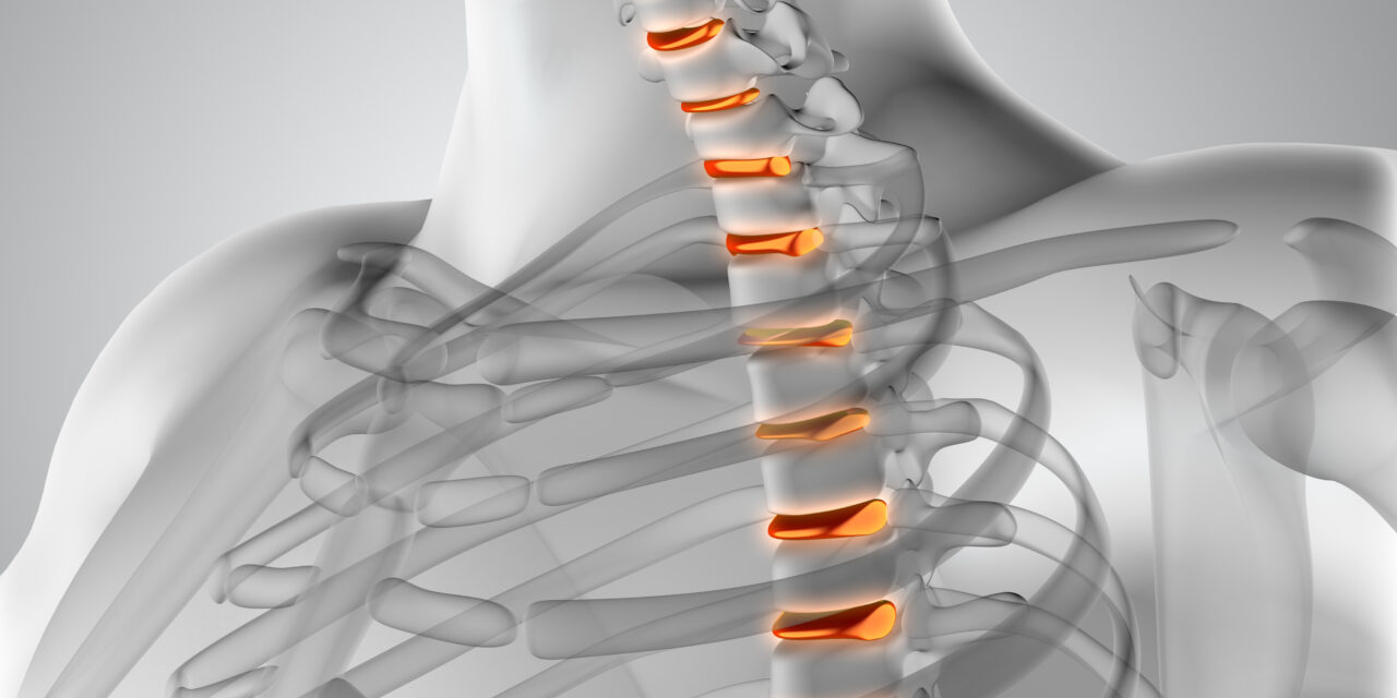 What are the First Signs of Spinal Cord Compression:Unveiling the Silent Threat