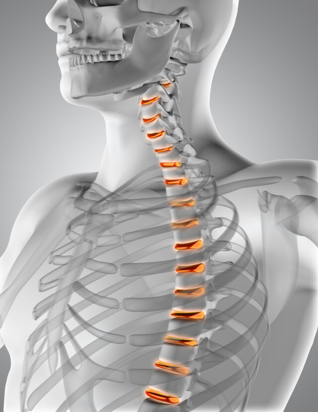 what are the first signs of spinal cord compression?